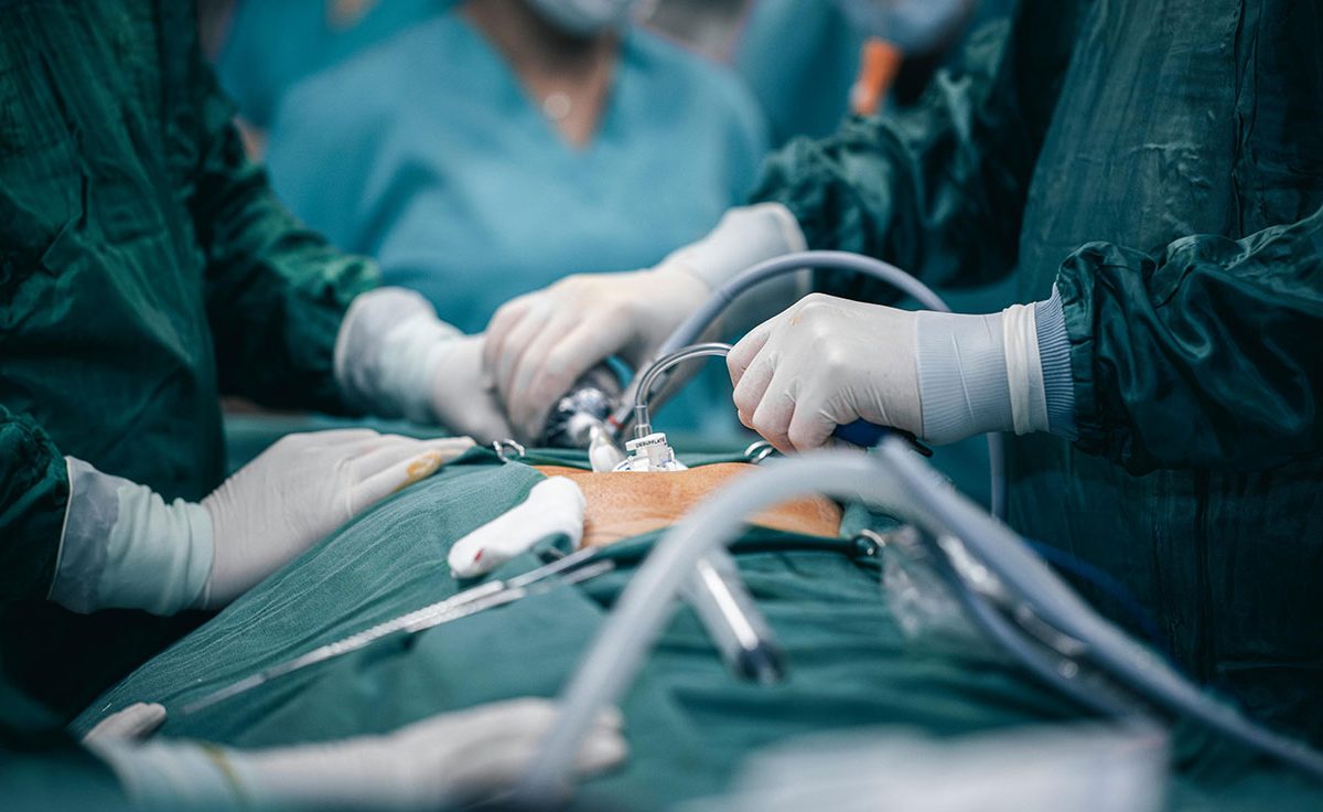 How to Handle Complications in Cosmetic Gynecology